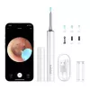 Pulitore per orecchie Bebird T15 Smart Visual bianco — otoscopio visivo per la pulizia delle orecchie