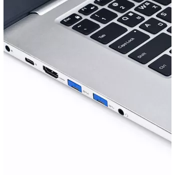 Smartkeeper UL03PKDB portblocker portblocker + chiave USB Type-A blu 6 pz.