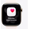 Smartwatch Apple Watch Ultra 3 GPS + Cellular 49mm cassa in titanio nero con cinturino Milanese Loop in titanio nero Medium