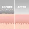 Dispositivo per la cura della pelle HoMedics MD-1000-EU2 microdermoabrasione a vuoto bianco