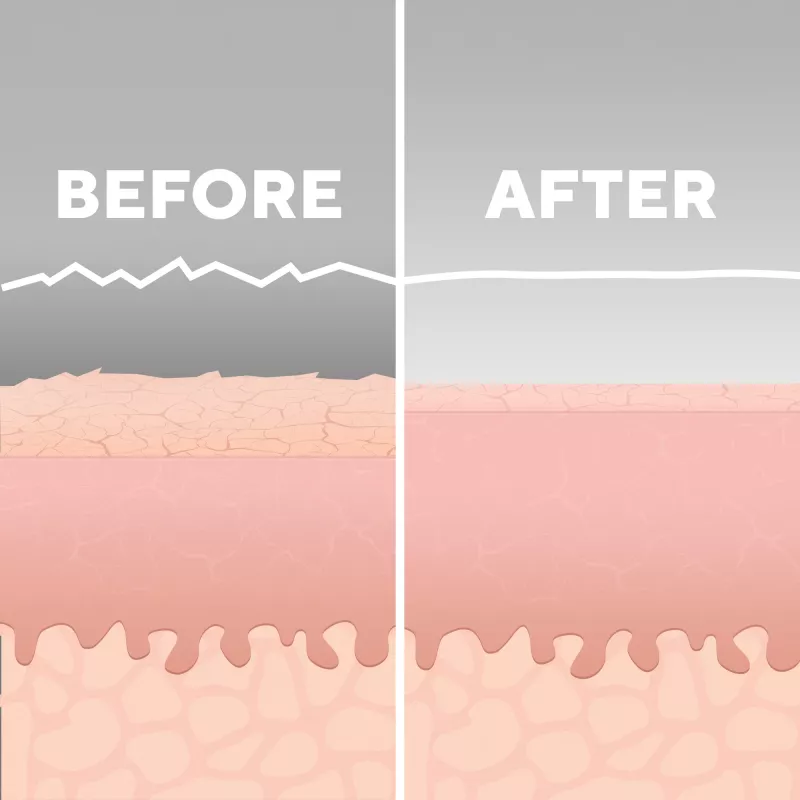 Dispositivo per la cura della pelle HoMedics MD-1000-EU2 microdermoabrasione a vuoto bianco