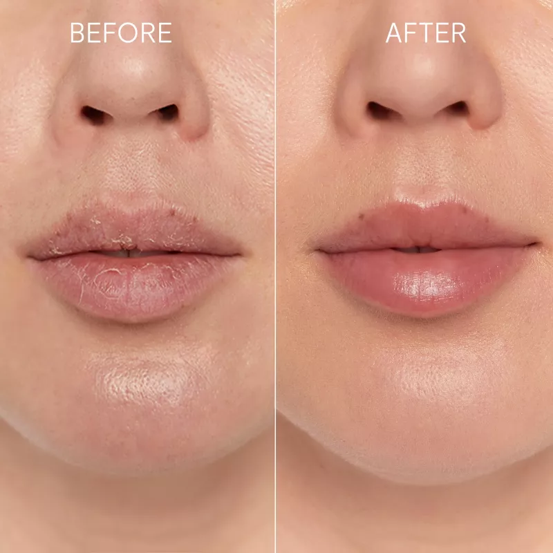 GLOV Scrubex Lip Exfoliating Mitt - confezione da 2 | Peeling labbra delicato in microfibra per labbra morbide