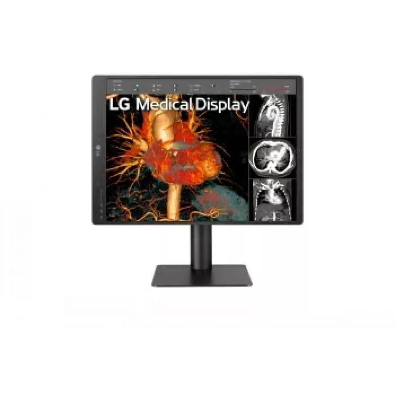 LG 21,3 pollici 3MP IPS Monitor per Diagnostica 21HQ513D-M