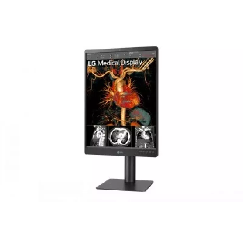 LG 21,3 pollici 3MP IPS Monitor per Diagnostica 21HQ513D-M